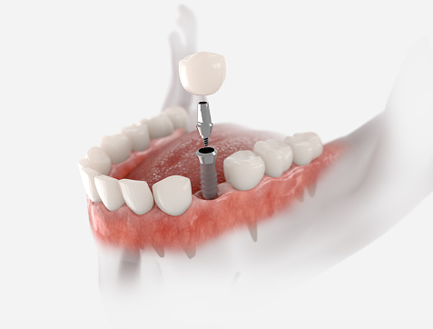 dental teeth visual